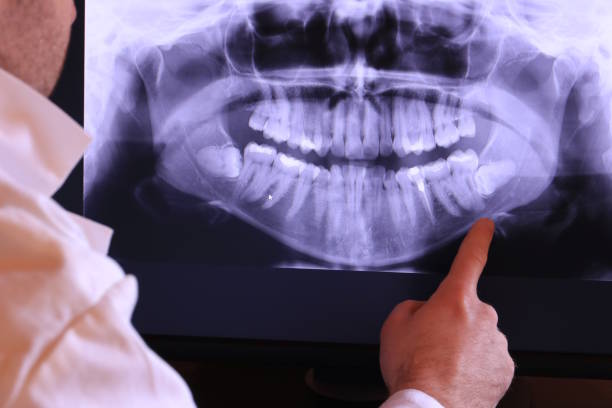 Best Emergency Dentist for Knocked-Out Tooth in Kingston Estates, NJ